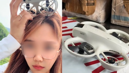 无人机突然落到头顶，3小时后，女子300多根头发没了